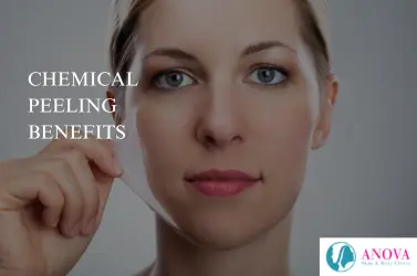 Chemical Peeling Benefits: Skin Improvements, Types, and What to Expect