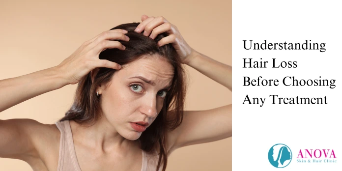 Understanding Hair Loss Before Choosing Any Treatment