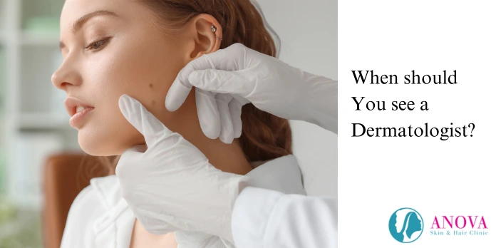 When Should You See a Dermatologist?