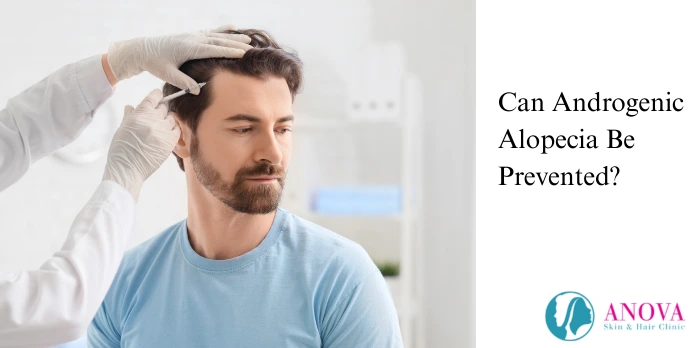 Can Androgenic Alopecia Be Prevented?
