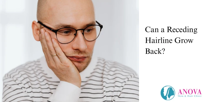 Can a Receding Hairline Grow Back?