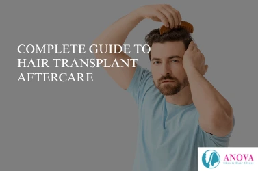 Complete Guide to Hair Transplant Aftercare for Safe & Successful Recovery