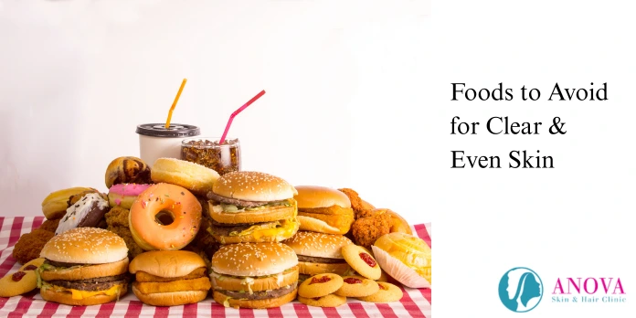 Foods to Avoid for Clear & Even Skin