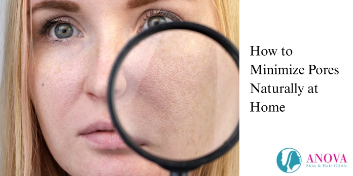 How to Minimize Pores Naturally at Home