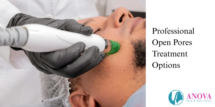 Professional Open Pores Treatment Options