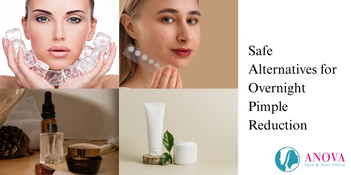 Safe Alternatives for Overnight Pimple Reduction