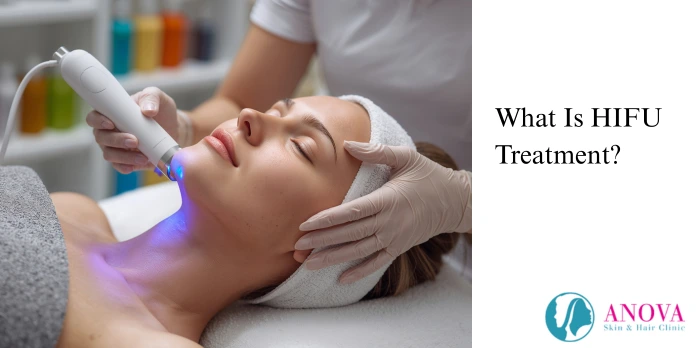 What Is HIFU Treatment?