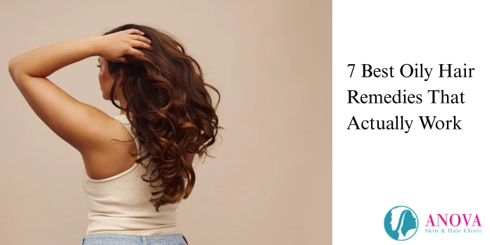 7 Best Oily Hair Remedies That Actually Work