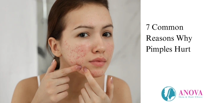 7 Common Reasons Why Pimples Hurt