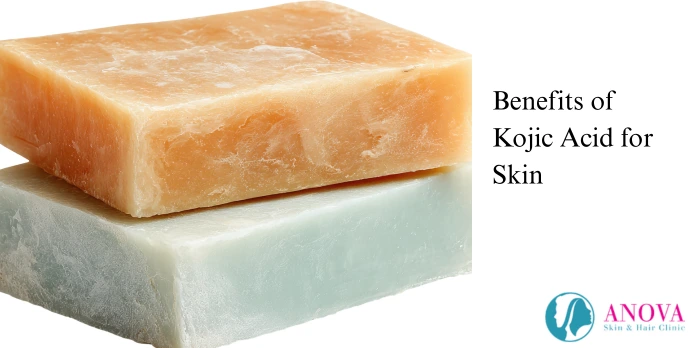 Benefits of Kojic Acid for Skin