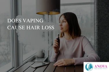 Does Vaping Cause Hair Loss