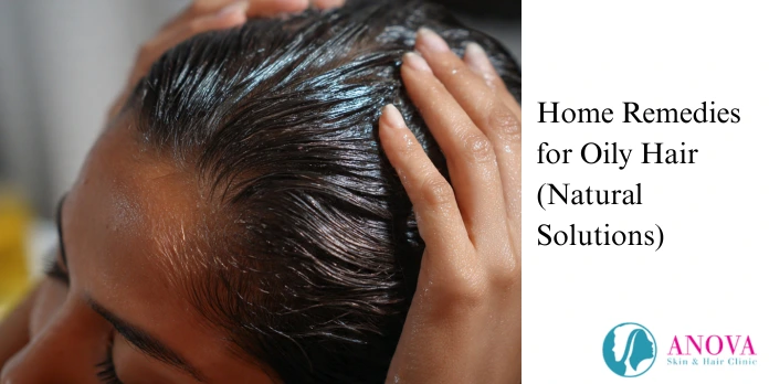 Home Remedies for Oily Hair (Natural Solutions)