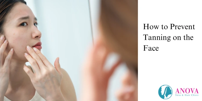 How to Prevent Tanning on the Face