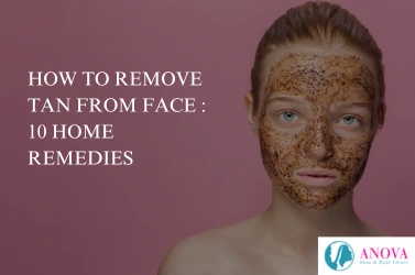 How to Remove Tan from Face: 10 Easy Home Remedies & Treatments
