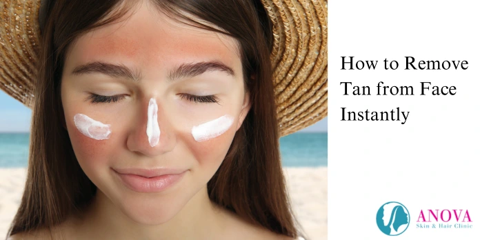 How to Remove Tan from Face Instantly