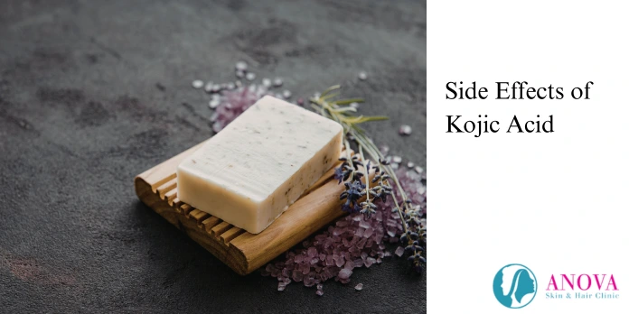 Side Effects of Kojic Acid