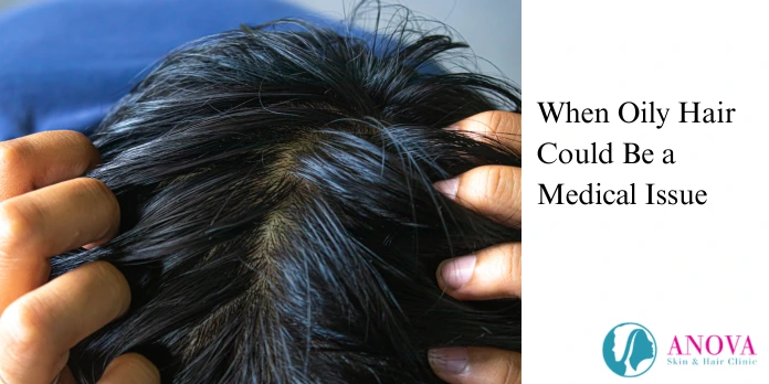 When Oily Hair Could Be a Medical Issue
