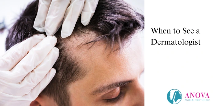 When to See a Dermatologist