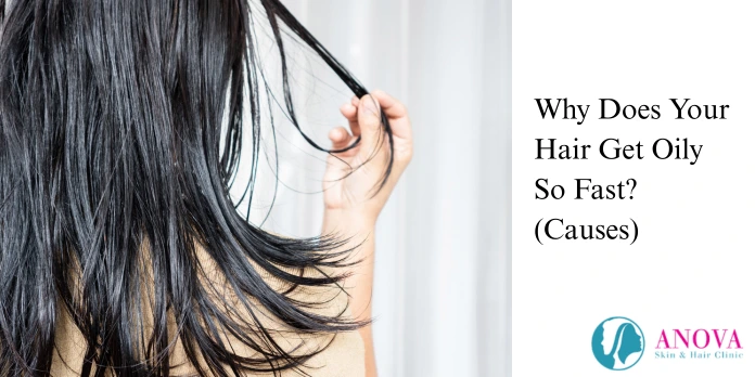 Why Does Your Hair Get Oily So Fast? (Causes)
