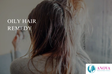 Oily Hair Remedy: Causes, Proven Solutions & Expert Treatments