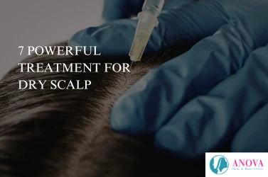 7 Powerful Treatment for Dry Scalp That Actually Work (Expert Guide)