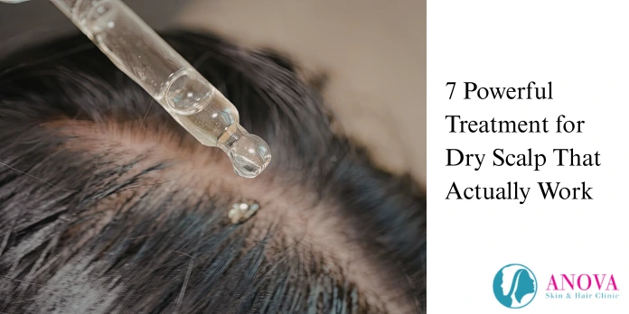 7 Powerful Treatment for Dry Scalp That Actually Work
