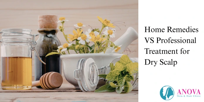 Home Remedies vs Professional Treatment for Dry Scalp