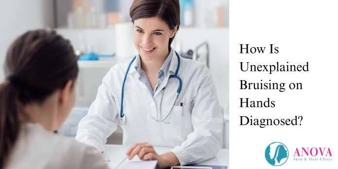 How to Treat Unexplained Bruising on Hands