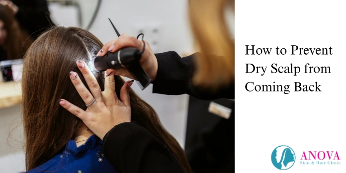 How to Prevent Dry Scalp from Coming Back