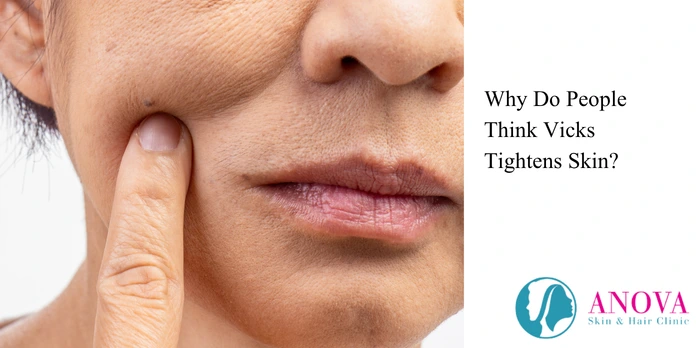 Why Do People Think Vicks Tightens Skin