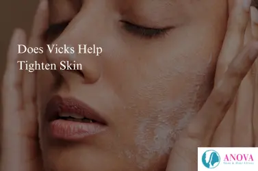 does vicks tighten skin